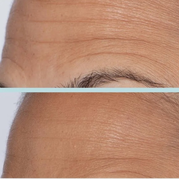 FIRST AID BEAUTY
Bounce-Boosting Serum with Collagen + Peptides NIB - Picture 10 of 11